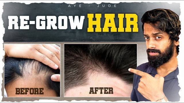 '5 Natural Ways To *RE GROW* Lost Hair