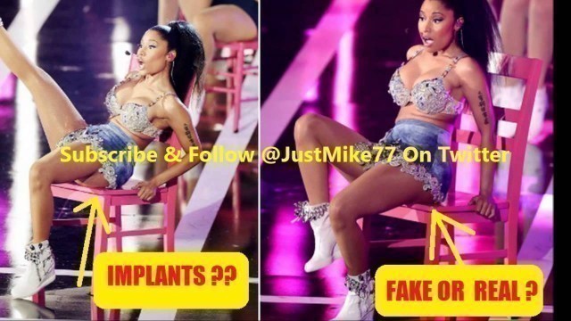 'Does Nicki Minaj Have Butt Implants?? You Decide!'